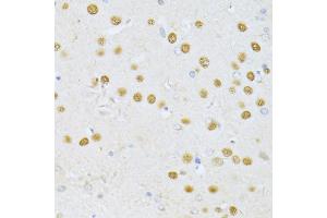 Immunohistochemistry of paraffin-embedded rat brain using SATB1 antibody (ABIN5973417) at dilution of 1/100 (40x lens). (SATB1 anticorps)