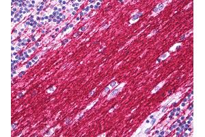 Anti-PLP1 antibody IHC of human brain cerebellum, neuropil.