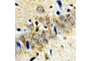Immunohistochemical analysis of GCN2 staining in rat brain  formalin fixed paraffin embedded tissue section. (GCN2 anticorps)