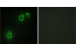 Immunofluorescence analysis of A549 cells, using TNR16 Antibody. (NGFR anticorps  (AA 121-170))