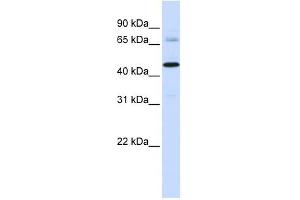 Sideroflexin 4 antibody used at 1 ug/ml to detect target protein.