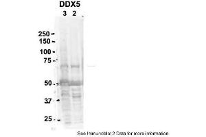 Sample Type: 2. (DDX5 anticorps  (C-Term))