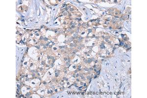 Immunohistochemistry of Human brain  using KCNQ5 Polyclonal Antibody at dilution of 1:60 (KCNQ5 anticorps)