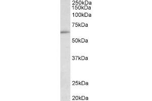 ABIN1049504 (0. (HIC2 anticorps  (AA 188-200))
