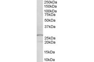 Western Blotting (WB) image for anti-Docking Protein 5 (DOK5) (AA 293-306) antibody (ABIN299685) (DOK5 anticorps  (AA 293-306))