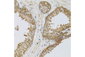 Immunohistochemistry of paraffin-embedded human prostate using TEFM antibody. (TEFM anticorps  (AA 36-210))
