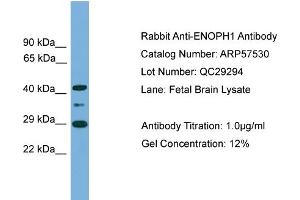 WB Suggested Anti-ENOPH1  Antibody Titration: 0. (MASA anticorps  (Middle Region))