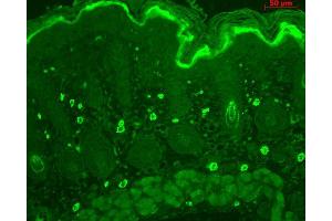 Immunohistochemistry analysis using Rabbit Anti-TNF-R1 Polyclonal Antibody .