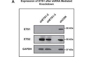 Loss of ETS1 affects SCC25 cell proliferation and migration. (ETS2 anticorps  (Center))