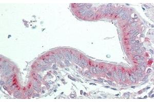 Detection of PLA2R1 in Human Lung Tissue using Polyclonal Antibody to Phospholipase A2 Receptor 1 (PLA2R1) (PLA2R1 anticorps  (AA 1418-1487))
