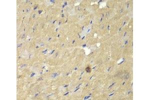 Immunohistochemistry of paraffin-embedded Mouse heart using AKR7A2 Polyclonal Antibody at dilution of 1:100 (40x lens). (AKR7A2 anticorps)
