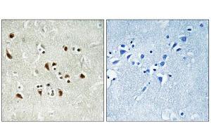 Immunohistochemistry analysis of paraffin-embedded human brain tissue using TUBGCP6 antibody. (GCP6 anticorps  (Internal Region))