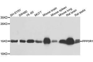 Western blot analysis of extracts of various cell lines, using PPP3R1 antibody. (PPP3R1 anticorps  (AA 11-170))