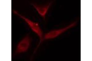 ABIN6274546 staining COLO205 cells by IF/ICC.