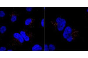 Immunofluorescent staining of HeLa cells incubated with MIB1 polyclonal antibody . (MIB1 anticorps  (N-Term))