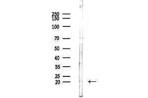 anti-CD164 Sialomucin-Like 2 (CD164L2) antibody