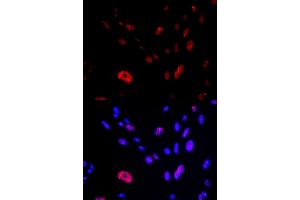 Immunofluorescence analysis of U2OS cells using HUS1 antibody (ABIN6131777, ABIN6142085, ABIN6142087 and ABIN6221056).