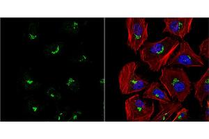 ICC/IF Image VBP1 antibody detects VBP1 protein at cytoplasm by immunofluorescent analysis. (VBP1 anticorps  (Center))
