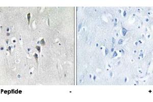 Immunohistochemical analysis of paraffin-embedded human brain tissue using CAMK2A/CAMK2D polyclonal antibody . (CAMK2A anticorps)