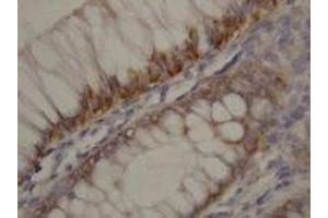 Image no. 1 for anti-rho-Associated, Coiled-Coil Containing Protein Kinase 2 (ROCK2) (N-Term) antibody (ABIN1495063) (ROCK2 anticorps  (N-Term))