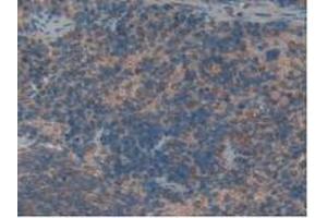 Detection of HK1 in Rat Spleen Tissue using Polyclonal Antibody to Hexokinase 1 (HK1)