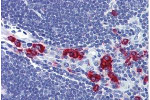 Thymus, Human: Formalin-Fixed, Paraffin-Embedded (FFPE)