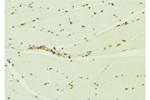 ABIN6276900 at 1/100 staining Mouse muscle tissue by IHC-P. (KEAP1 anticorps  (N-Term))