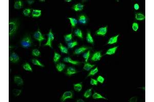 Immunofluorescence staining of Hela cells with ABIN7168990 at 1:141, counter-stained with DAPI.
