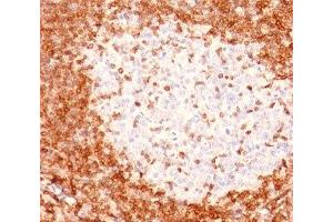 IHC testing of human tonsil stained with Bcl-2 antibody (8C8).