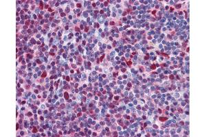 Anti-CHD4 antibody IHC of human tonsil.