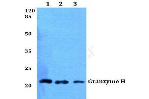 Western blot (WB) analysis of Granzyme H antibody  at 1/500 dilution.