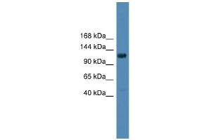 WB Suggested Anti-DGKQ Antibody Titration: 0. (DGKQ anticorps  (Middle Region))