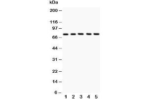 Western blot testing of 12 Lipoxygenase antibody and Lane 1:  A549;  2: MCF-7;  3: COLO320;  4: Jurkat;  5: HeLa;  Predicted size: 75KD;  Observed size: 75KD (12-Lipoxygenase anticorps  (C-Term))