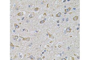 Immunohistochemistry of paraffin-embedded Rat brain using FASTKD1 Polyclonal Antibody at dilution of 1:100 (40x lens). (FASTKD1 anticorps)
