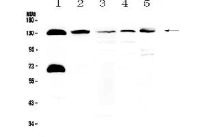 Western blot analysis of NEDD4-2 using anti-NEDD4-2 antibody . (NEDD4-2 anticorps  (AA 703-975))