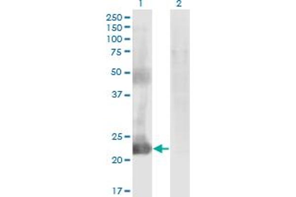 CCDC115 anticorps  (AA 1-132)