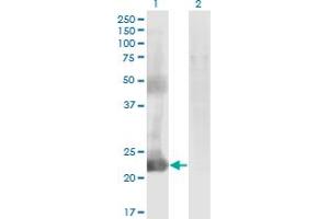 Western Blot analysis of CCDC115 expression in transfected 293T cell line by CCDC115 monoclonal antibody (M05), clone 4E9.