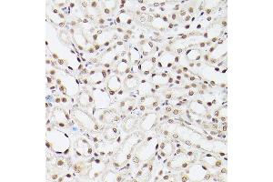 Immunohistochemistry of paraffin-embedded Mouse kidney using EP300 antibody (ABIN6127823, ABIN6140193, ABIN6140194 and ABIN6216844) at dilution of 1:100 (40x lens). (p300 anticorps  (AA 1-270))