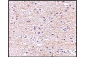 Immunohistochemistry of SATB2 in human brain with this product at 5 μg/ml.