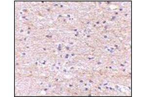 Immunohistochemistry of SATB2 in human brain with this product at 5 μg/ml. (SATB2 anticorps  (N-Term))