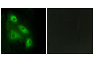 Immunofluorescence analysis of HeLa cells, using ES8L3 antibody. (EPS8-Like 3 anticorps  (Internal Region))