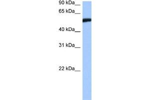 WB Suggested Anti-HMG20A Antibody   Titration: 1. (HMG20A anticorps  (Middle Region))