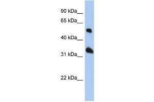 WB Suggested Anti-TSPAN33 Antibody Titration: 0. (TSPAN33 anticorps  (Middle Region))