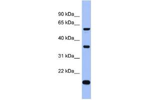 WB Suggested Anti-LAntibody Titration:  0. (LARP6 anticorps  (Middle Region))