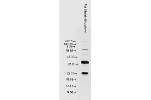 Western blot analysis of Rat Skeletal muscle lysates showing detection of HSP22 protein using Rabbit Anti-HSP22 Polyclonal Antibody . (HSPB8 anticorps  (Atto 594))
