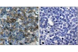 Immunohistochemistry analysis of paraffin-embedded human tonsil, using VASP (Phospho-Ser157) Antibody.