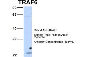 Host: Rabbit Target Name: TRAF6 Sample Type: Human Adult Placenta Antibody Dilution: 1. (TRAF6 anticorps  (Middle Region))