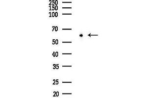 Western blot analysis of lysates from F10-LUC cells(heat-shock 45 min treatment), using ZNF695 Antibody at 1/1000 dilution.