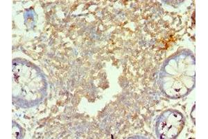 Immunohistochemistry of paraffin-embedded human colon tissue using ABIN7160219 at dilution of 1:100