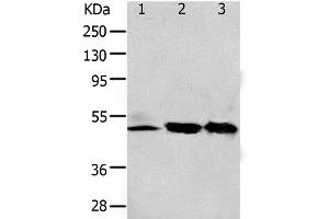 Western Blot analysis of 293T and K562 cell, Human fetal kidney tissue using F2R Polyclonal Antibody at dilution of 1:650 (PAR1 anticorps)